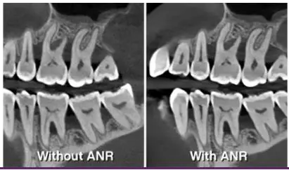 CS-8200-3D–NEO-EDITION6