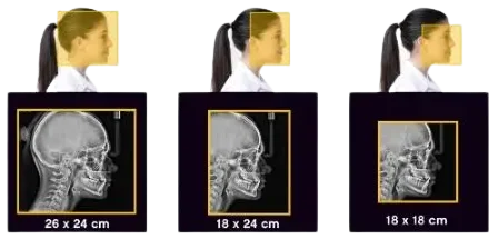 MÓDULO-CEFALOMÉTRICO-Y-SOFTWARE