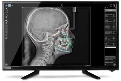 MÓDULO-CEFALOMÉTRICO-Y-SOFTWARE2