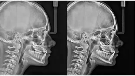 MÓDULO-CEFALOMÉTRICO-Y-SOFTWARE3