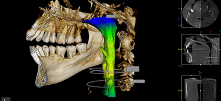 8_16x10_airway-analysis-thumbnail