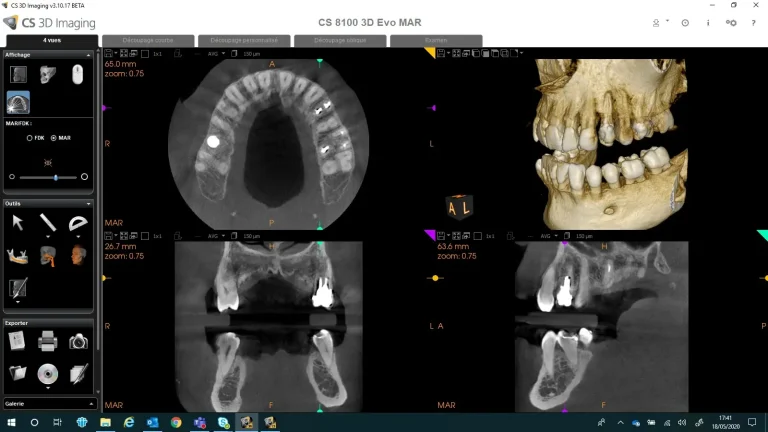 CS+8100+3D+Evo_MAR+4+view