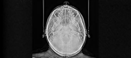 ceph-image-4-thumbnail