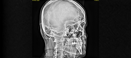 ceph-image-6-thumbnail