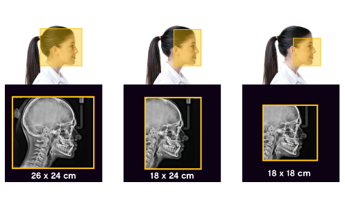 ceph-imaging---feature-1
