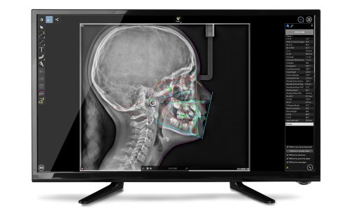 ceph-imaging---feature-4