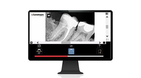 rvg-142-teaser-5-452