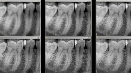 rvg_6200_r107_sharpnesslevels-451x252